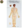 Moxibustion Acupoint Chart
